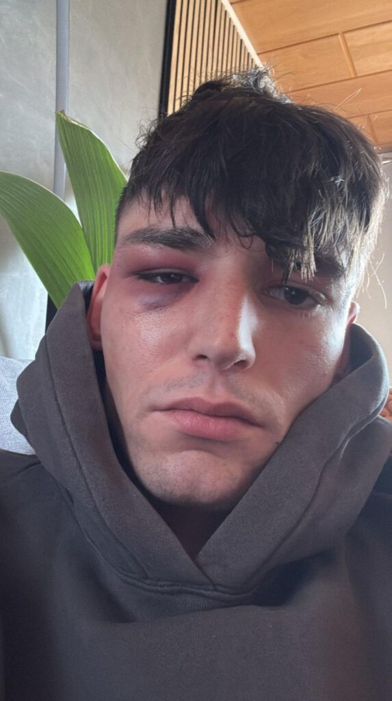 Pascal Kaiser tras ser agredido